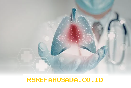 Dokter Spesialis Paru Terbaik di Medan yang Paling Banyak Direkomendasikan Pasien!