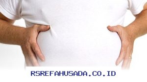 Tips Ampuh Atasi Perut Kembung dan Jaga Kesehatan Pencernaan Anda!