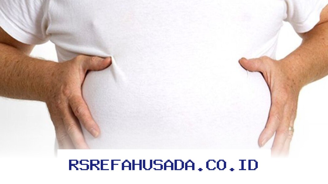 Tips Ampuh Atasi Perut Kembung dan Jaga Kesehatan Pencernaan Anda!